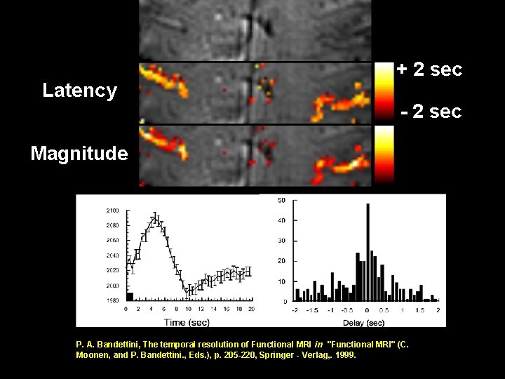 Latency + 2 sec - 2 sec Magnitude P. A. Bandettini, The temporal resolution Latency + 2 sec - 2 sec Magnitude P. A. Bandettini, The temporal resolution