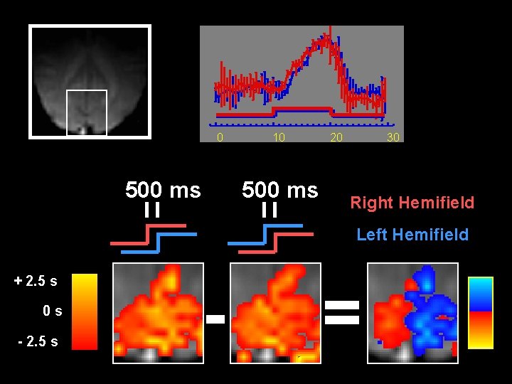 0 500 ms 10 500 ms 20 30 Right Hemifield Left Hemifield + 2. 0 500 ms 10 500 ms 20 30 Right Hemifield Left Hemifield + 2.