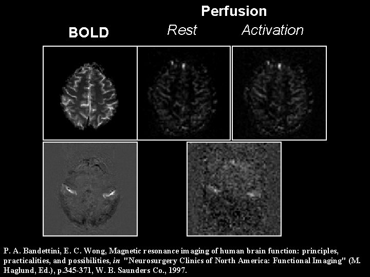 BOLD Perfusion Rest Activation P. A. Bandettini, E. C. Wong, Magnetic resonance imaging of BOLD Perfusion Rest Activation P. A. Bandettini, E. C. Wong, Magnetic resonance imaging of