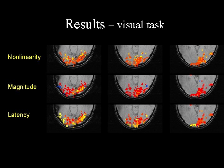 Results – visual task Nonlinearity Magnitude Latency Results – visual task Nonlinearity Magnitude Latency