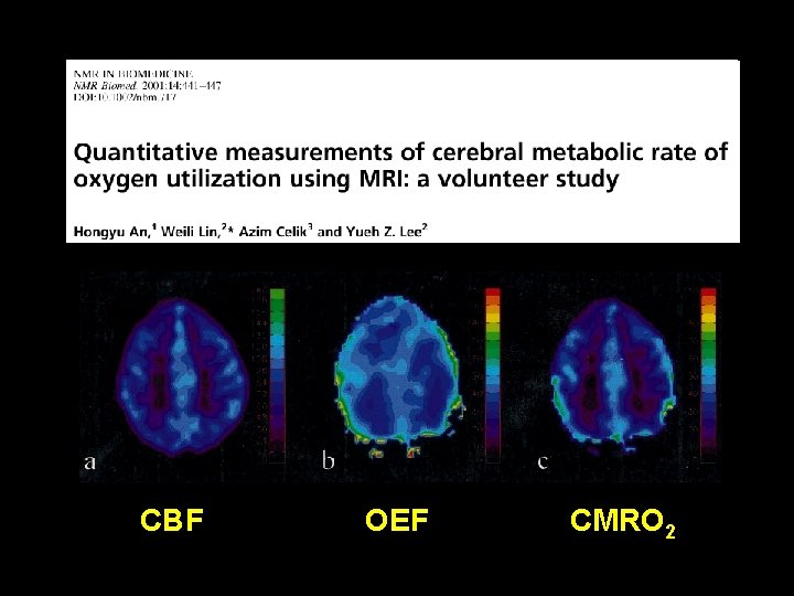 CBF OEF CMRO 2 CBF OEF CMRO 2