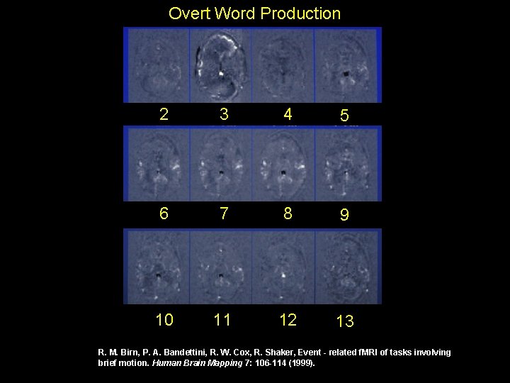 Overt Word Production 2 3 4 5 6 7 8 9 10 11 12 Overt Word Production 2 3 4 5 6 7 8 9 10 11 12