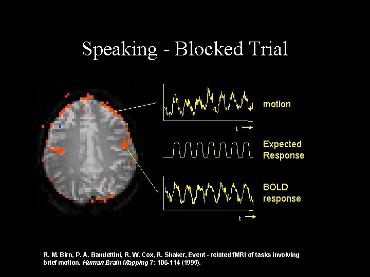 Speaking - Blocked Trial motion t Expected Response BOLD response t R. M. Birn, Speaking - Blocked Trial motion t Expected Response BOLD response t R. M. Birn,