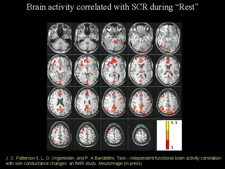 Brain activity correlated with SCR during “Rest” J. C. Patterson II, L. G. Ungerleider, Brain activity correlated with SCR during “Rest” J. C. Patterson II, L. G. Ungerleider,