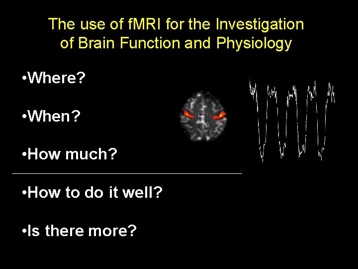 The use of f. MRI for the Investigation of Brain Function and Physiology • The use of f. MRI for the Investigation of Brain Function and Physiology •