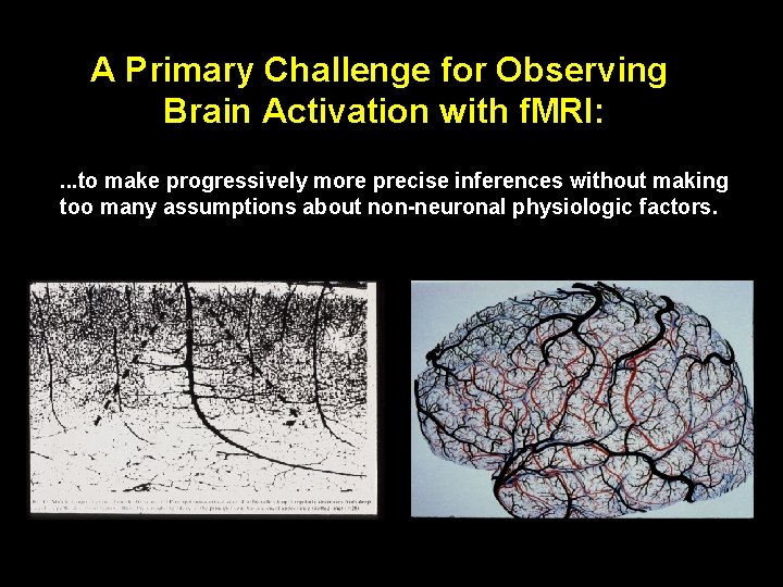 A Primary Challenge for Observing Brain Activation with f. MRI: . . . to A Primary Challenge for Observing Brain Activation with f. MRI: . . . to