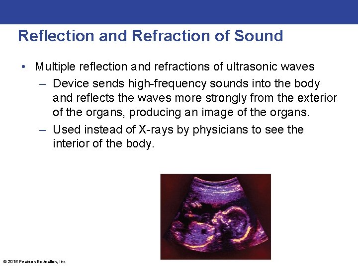 Reflection and Refraction of Sound • Multiple reflection and refractions of ultrasonic waves –