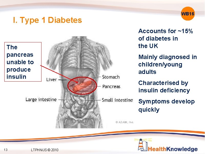 I. Type 1 Diabetes The pancreas unable to produce insulin WB 16 Accounts for