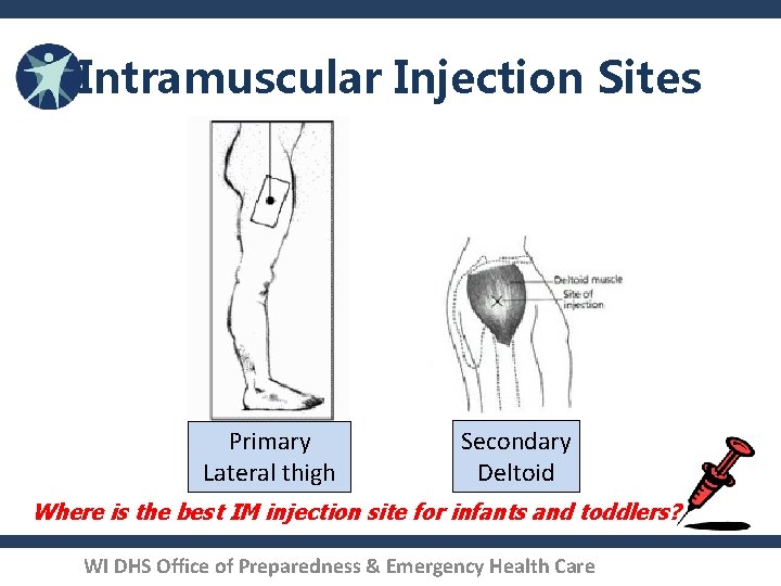 Intramuscular Injection Sites Primary Lateral thigh Secondary Deltoid Where is the best IM injection