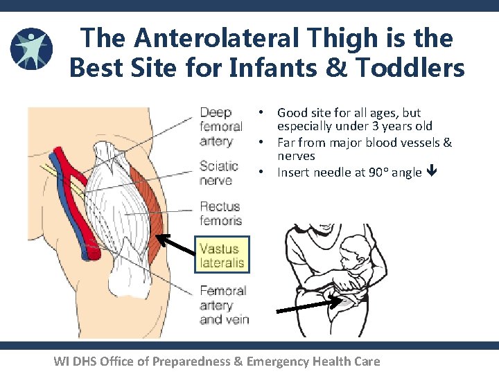 The Anterolateral Thigh is the Best Site for Infants & Toddlers • Good site