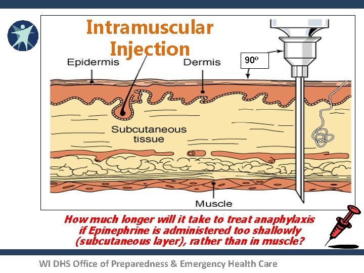 Intramuscular Injection 90º How much longer will it take to treat anaphylaxis if Epinephrine