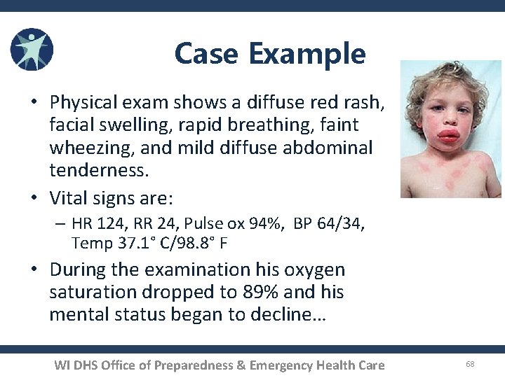 Case Example • Physical exam shows a diffuse red rash, facial swelling, rapid breathing,