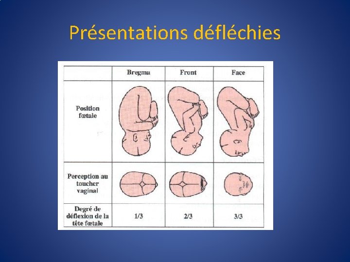 Présentations défléchies 