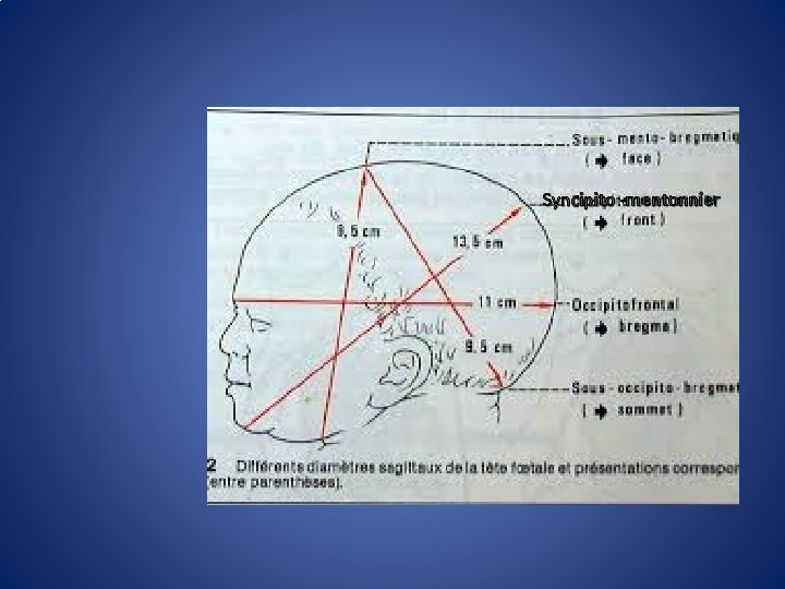 Syncipito -mentonnier 