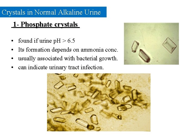 Crystals in Normal Alkaline Urine 1 - Phosphate crystals • • found if urine