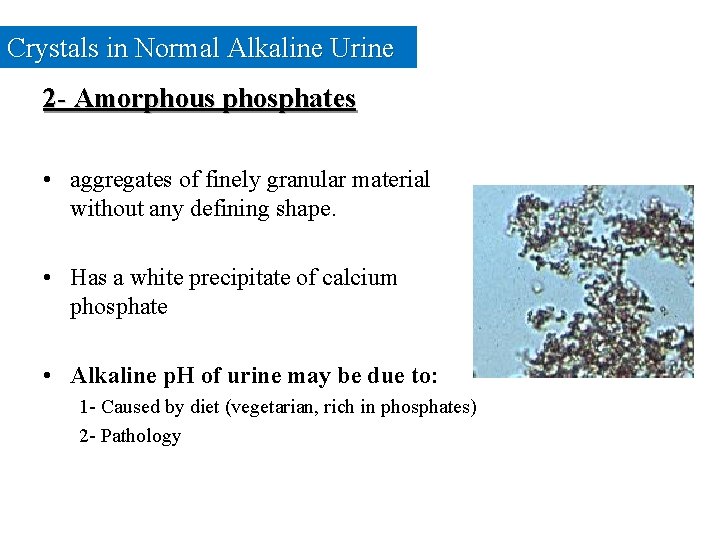 Crystals in Normal Alkaline Urine 2 - Amorphous phosphates • aggregates of finely granular