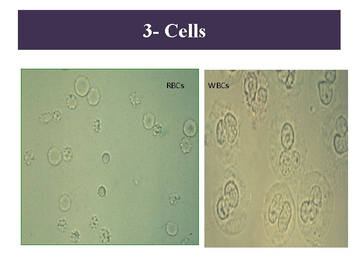 3 - Cells Microscopic analysis • RBCs: RBCs WBCs 