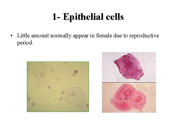 1 - Epithelial cells • Little amount normally appear in female due to reproductive