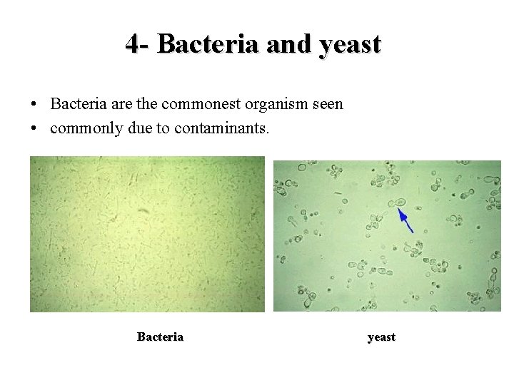 4 - Bacteria and yeast • Bacteria are the commonest organism seen • commonly