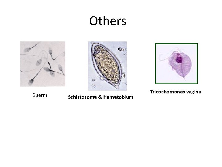 Others Sperm Schistosoma & Hematobium Tricochomonas vaginal 