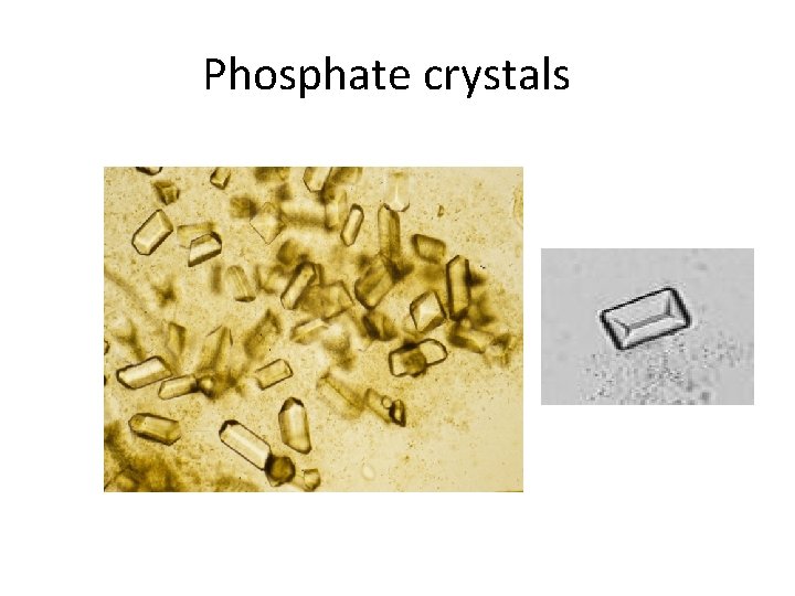 Phosphate crystals 