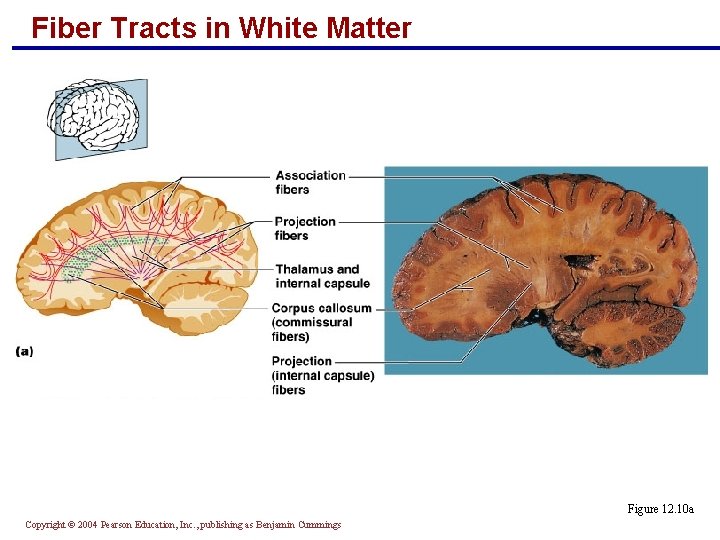 Fiber Tracts in White Matter Figure 12. 10 a Copyright © 2004 Pearson Education,