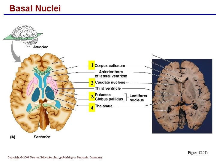 Basal Nuclei 1 2 3 4 Figure 12. 11 b Copyright © 2004 Pearson