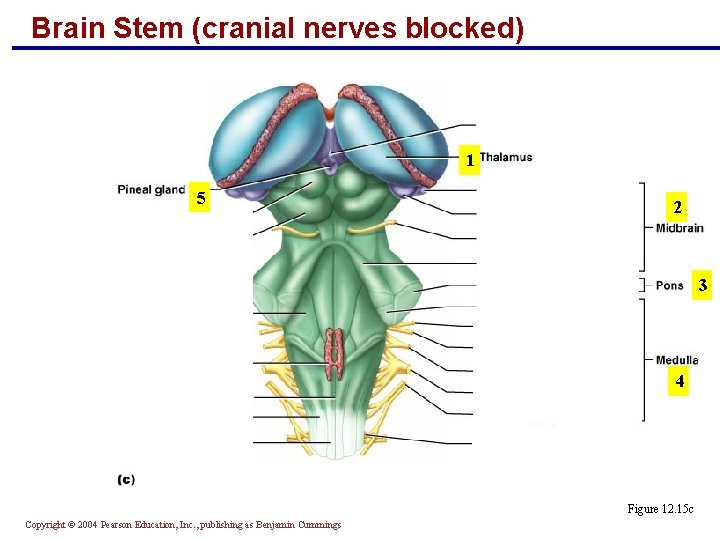 Brain Stem (cranial nerves blocked) 1 5 2 3 4 Figure 12. 15 c