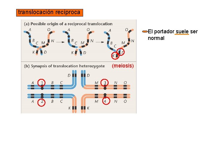 translocación recíproca El portador suele ser normal (meiosis) Su descendencia puede ser: normal con