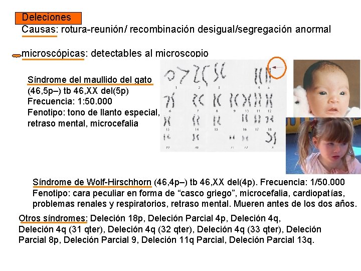 Deleciones Causas: rotura-reunión/ recombinación desigual/segregación anormal microscópicas: detectables al microscopio Síndrome del maullido del