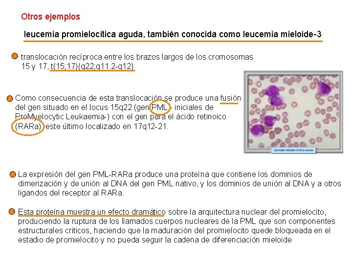 Otros ejemplos leucemia promielocítica aguda, también conocida como leucemia mieloide-3 translocación recíproca entre los