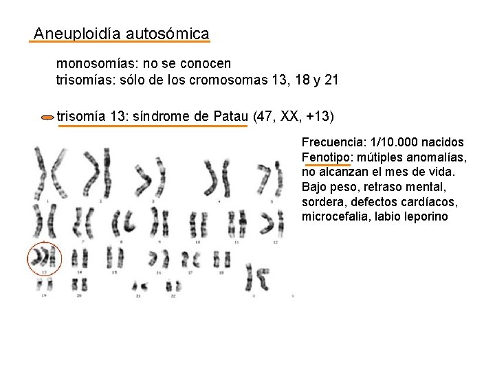 Aneuploidía autosómica monosomías: no se conocen trisomías: sólo de los cromosomas 13, 18 y