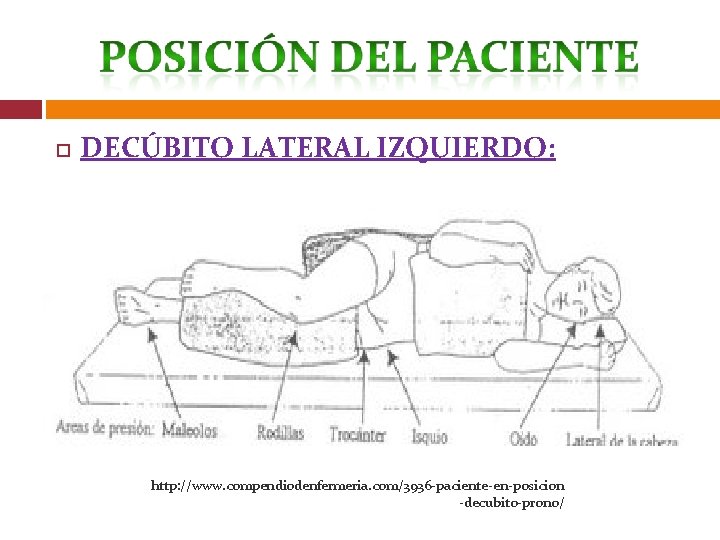  DECÚBITO LATERAL IZQUIERDO: http: //www. compendiodenfermeria. com/3936 -paciente-en-posicion -decubito-prono/ 