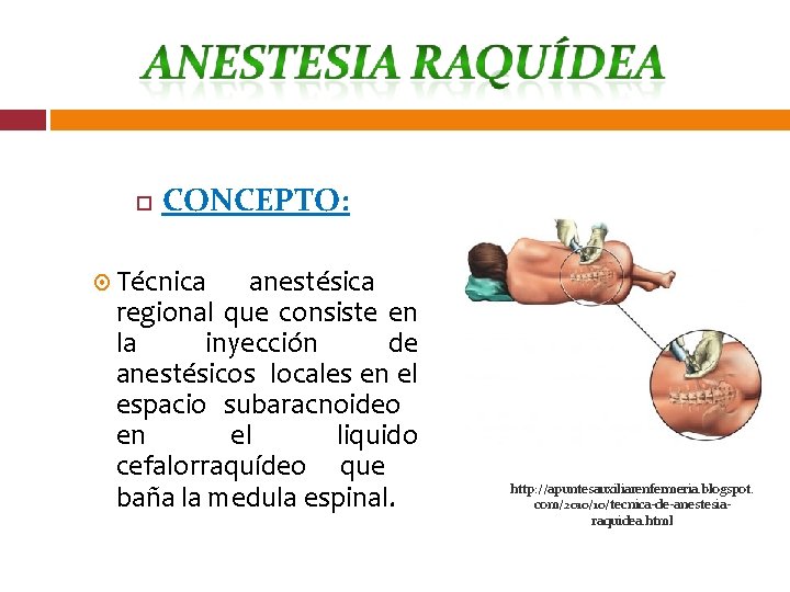  CONCEPTO: Técnica anestésica regional que consiste en la inyección de anestésicos locales en