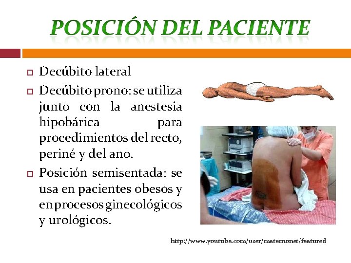  Decúbito lateral Decúbito prono: se utiliza junto con la anestesia hipobárica para procedimientos