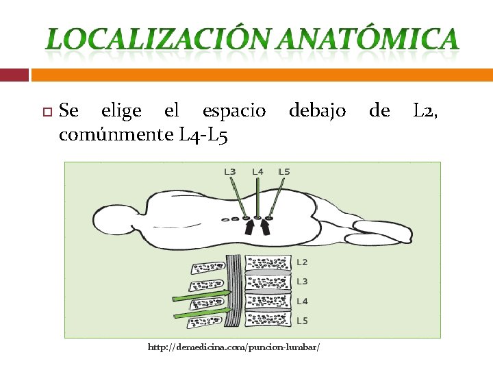  Se elige el espacio debajo de L 2, comúnmente L 4 -L 5