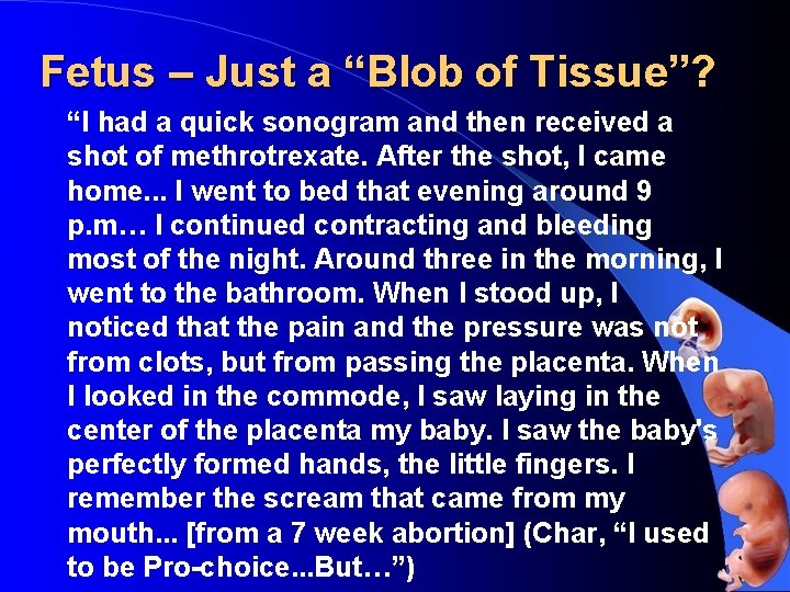 Fetus – Just a “Blob of Tissue”? “I had a quick sonogram and then