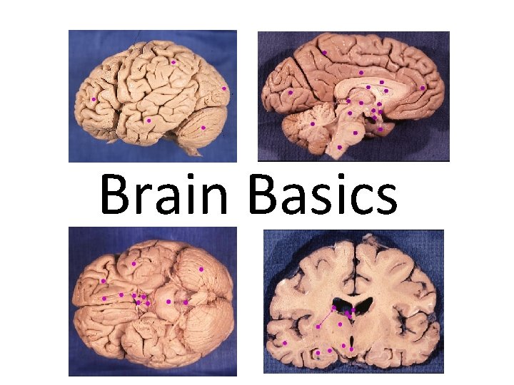 Brain Basics 