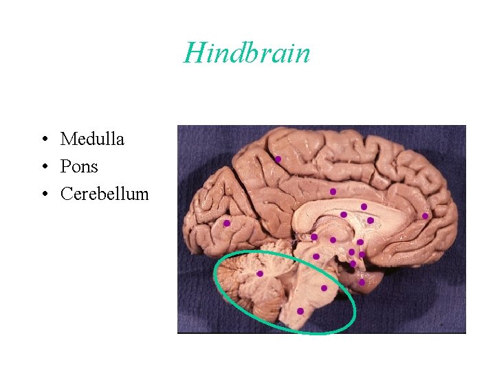 Hindbrain • Medulla • Pons • Cerebellum 