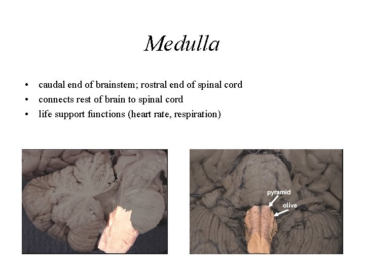Medulla • caudal end of brainstem; rostral end of spinal cord • connects rest