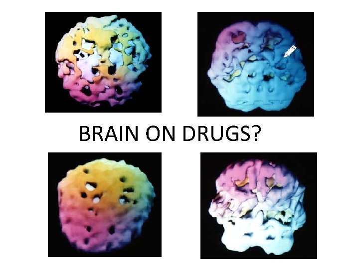 BRAIN ON DRUGS? 