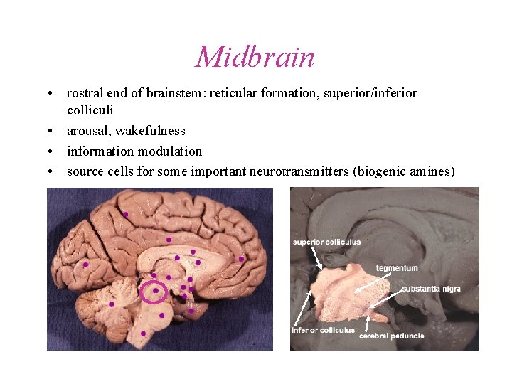 Midbrain • rostral end of brainstem: reticular formation, superior/inferior colliculi • arousal, wakefulness •