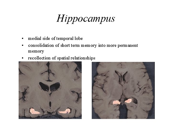 Hippocampus • medial side of temporal lobe • consolidation of short term memory into