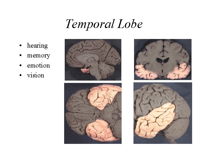 Temporal Lobe • • hearing memory emotion vision 