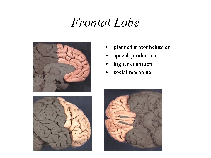 Frontal Lobe • • planned motor behavior speech production higher cognition social reasoning 