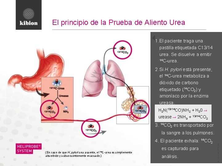 El principio de la Prueba de Aliento Urea 1. El paciente traga una pastilla