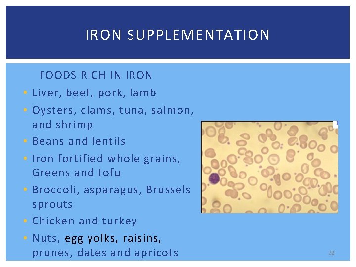 IRON SUPPLEMENTATION FOODS RICH IN IRON • Liver, beef, pork, lamb • Oysters, clams,