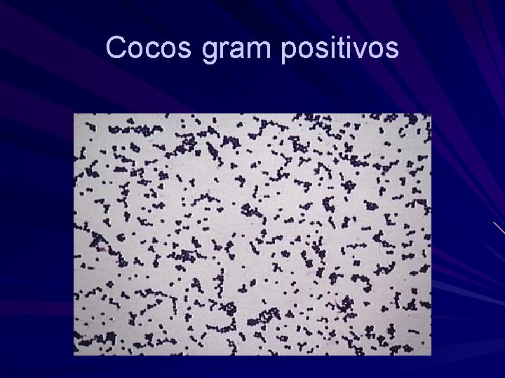 Cocos gram positivos 