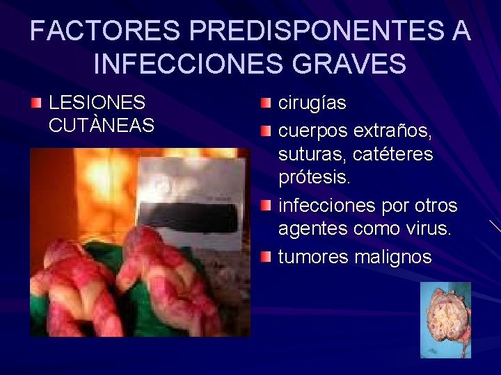 FACTORES PREDISPONENTES A INFECCIONES GRAVES LESIONES CUTÀNEAS cirugías cuerpos extraños, suturas, catéteres prótesis. infecciones