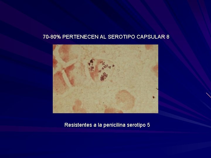 70 -80% PERTENECEN AL SEROTIPO CAPSULAR 8 Resistentes a la penicilina serotipo 5 